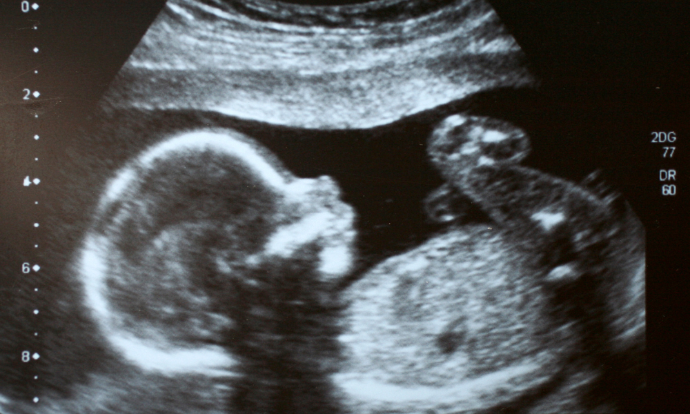 Bébé, macrosomie : est-ce vraiment inquiétant pour l'accouchement ?